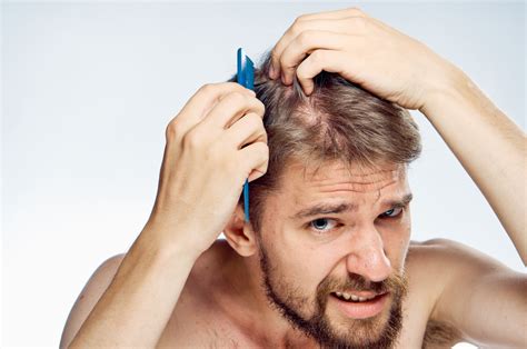 beta blockers hair loss|Hair Loss Side Effect from Beta Blockers Is Devastating.